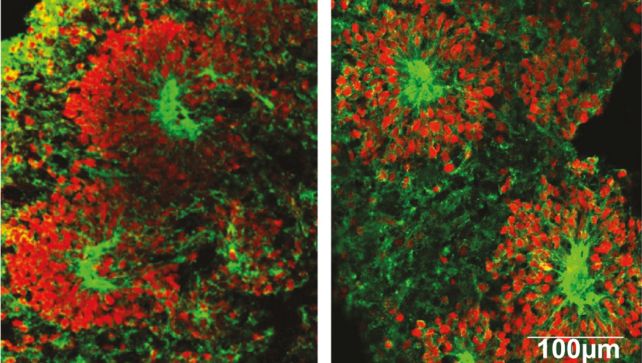 Vlevo minimozky co zůstaly na Zemi, vpravo minimozky po návratu z ISS. Kredit: Marotta et al. (2024), Stem Cells Translational Medicine.