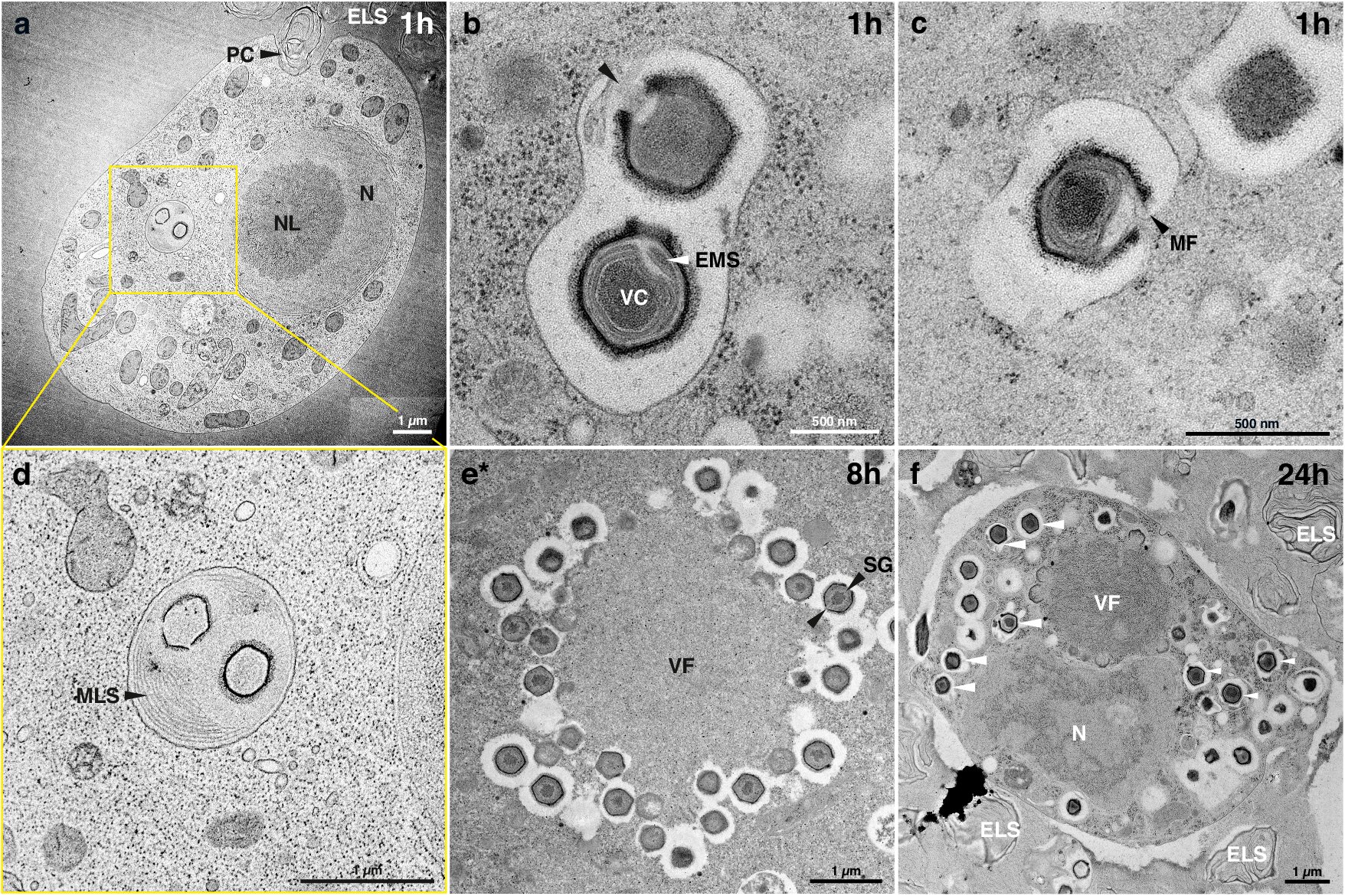 Cyklus Naegleriaviru. Kredit: Arthofer et al. (2024), Nature Communications.