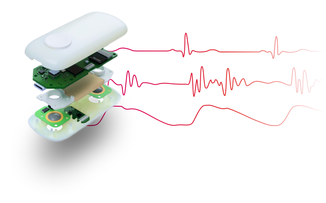 Senzor CardioTag spracúva 3 signály - elektrokardiogram, seizmokardiogram a pletyzmogram. Kredit: CARDIOSENSE.