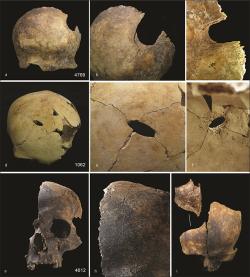 Lebeční kosti mrtvých z Charterhouse. Kredit: Schulting et al. (2024), Antiquity.