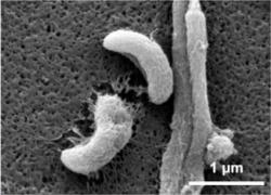 Elektronový rastrovací mikroskop dokládá rozklad povrchové vrstvy PVA a kyseliny
borité mořskými bakteriemi. Kredit: Korea Advanced Institute of Science and
Technology